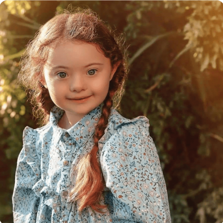 girl-with-down-syndrome_7.png